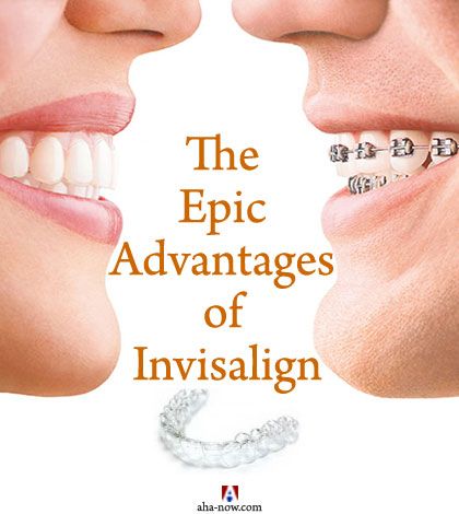 A comparison photo of a person with metallic braces and another with Invisalign to show the advantages of Invisalign