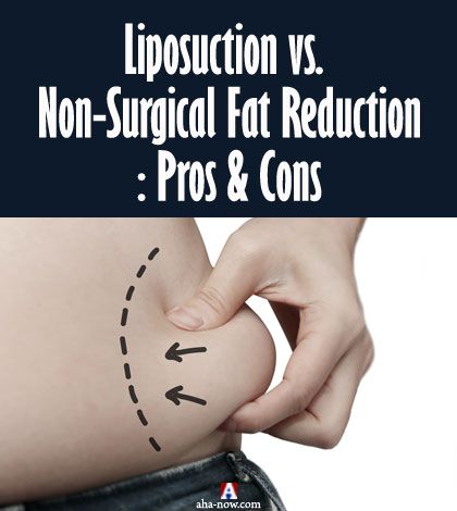 The Pros and Cons of Liposuction